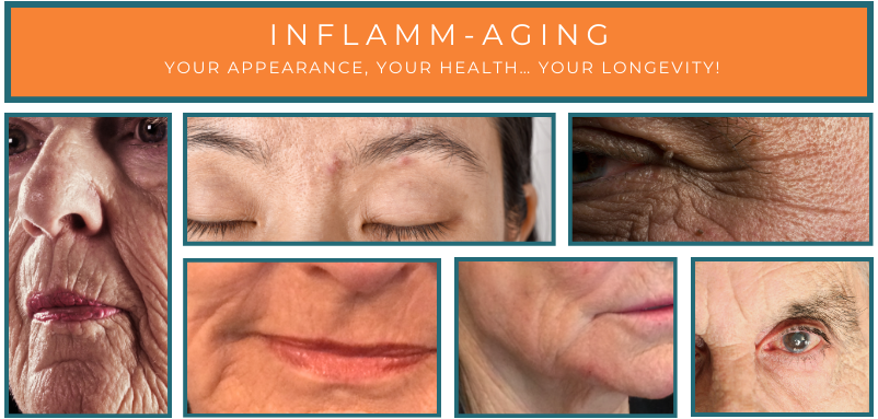 Inflamm-Aging
